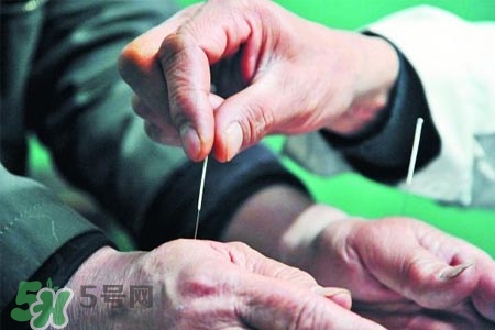 沒病可以針灸嗎？沒病可以扎針嗎？