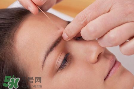 沒病可以針灸嗎？沒病可以扎針嗎？