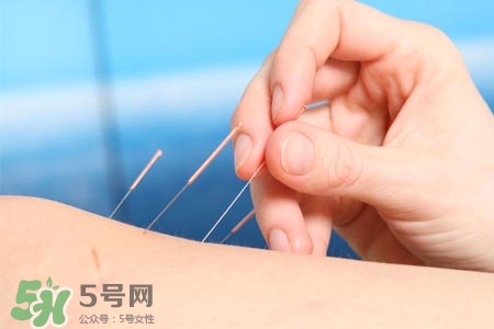 沒病可以針灸嗎？沒病可以扎針嗎？