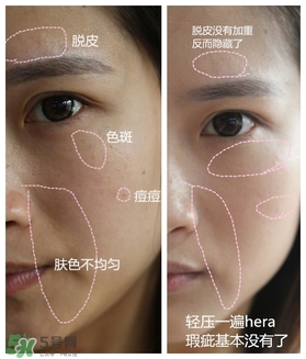 赫拉氣墊用了悶痘嗎？赫拉氣墊悶痘怎么辦？