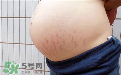 妊娠紋幾個(gè)月開(kāi)始出現(xiàn)？妊娠紋能消除掉嗎？