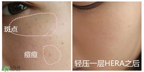 赫拉氣墊用了悶痘嗎？赫拉氣墊悶痘怎么辦？