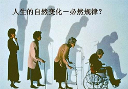 哪些人容易得骨質(zhì)疏松癥？骨質(zhì)疏松的高發(fā)人群有哪些？