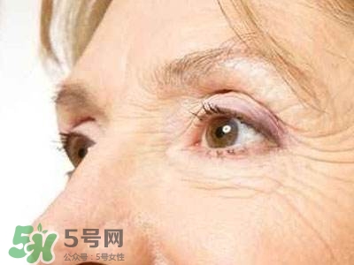 老年斑是怎么形成的？老年斑的形成原因