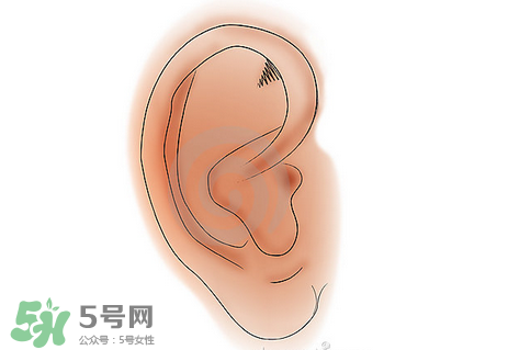 中耳炎有什么癥狀？中耳炎的癥狀表現(xiàn)
