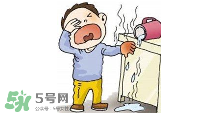 燙傷可以用牙膏嗎？燙傷用牙膏管用嗎？