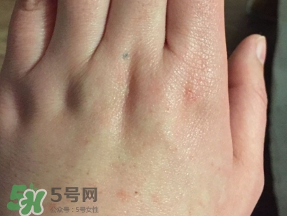 薇諾娜適合什么皮膚？薇諾娜適合敏感肌嗎？