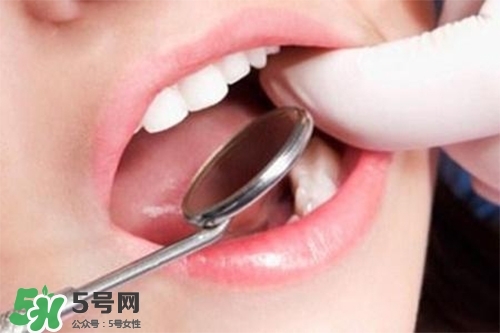 口腔異味是怎么回事？口腔異味怎么清除？