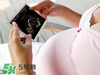 保胎期間可以洗澡嗎？臥床保胎可以洗澡嗎？