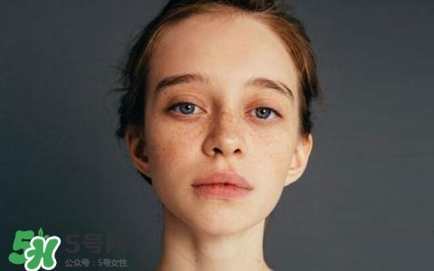 長(zhǎng)斑是什么原因引起的？祛斑效果最好的方法