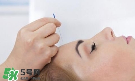 叢集性頭痛會(huì)死人嗎？叢集性頭痛的特點(diǎn)