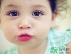 孕期可以激光祛斑嗎？懷孕了能做激光祛斑嗎？