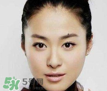 如何預防臉上長痣？怎樣預防臉上長痣