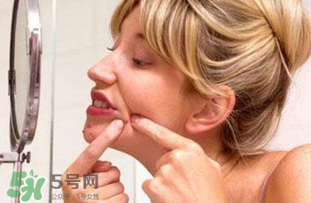 下巴長痘怎么辦？下巴長痘怎么調(diào)理