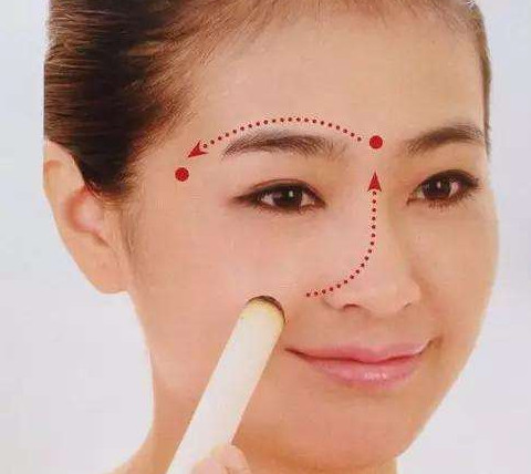 艾灸可以去黑眼圈嗎？艾灸可不可以去黑眼圈