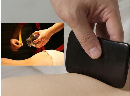 刮痧之后可以拔罐嗎？刮痧之后可不可以拔罐