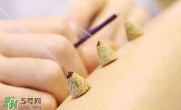 剛懷孕可以艾灸嗎？剛懷孕可以艾灸腹部嗎