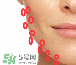 nuface美容儀有效嗎？nuface美容儀副作用？
