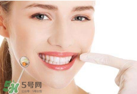如何去掉牙結(jié)石？牙結(jié)石怎么去除