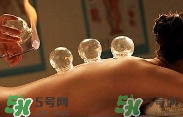 拔火罐疼嗎？拔火罐疼不疼