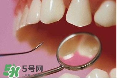 牙周炎傳染嗎？牙周炎會(huì)不會(huì)傳染