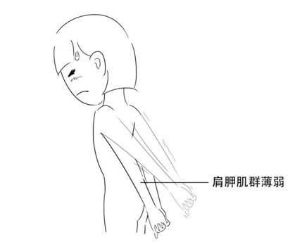 高低肩怎么糾正？高低肩的危害