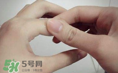 痛風有什么癥狀？女性痛風的初期癥狀