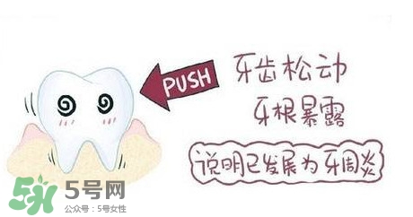 牙齒松動(dòng)能自己恢復(fù)嗎？牙齒松動(dòng)會(huì)自己恢復(fù)嗎