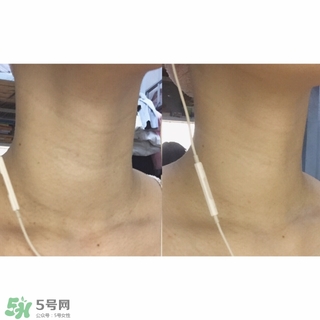 悅薇適合什么年齡？資生堂悅薇適合年齡段