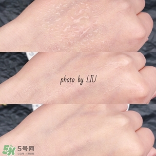 美帕b5噴霧有激素嗎？美帕噴霧副作用