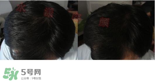  資生堂不老林洗發(fā)水怎么樣？資生堂不老林洗發(fā)水能長(zhǎng)頭發(fā)嗎