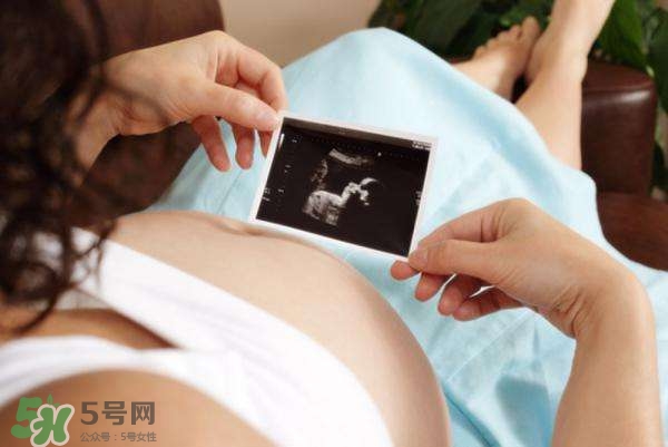 四維彩超能看出男女嗎？四維彩超能看清手指嗎？