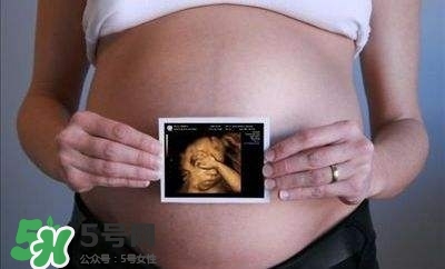 四維彩超能看出男女嗎？四維彩超能看清手指嗎？