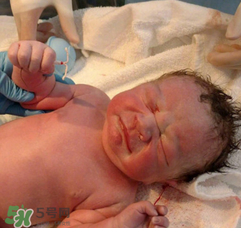 新生兒手握避孕環(huán)出生是怎么回事？出生后健康嗎？