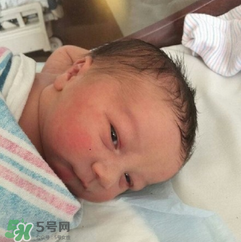 新生兒手握避孕環(huán)出生是怎么回事？出生后健康嗎？