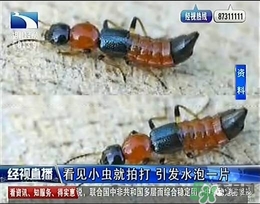 隱翅蟲有毒嗎？隱翅蟲會(huì)毀容嗎？