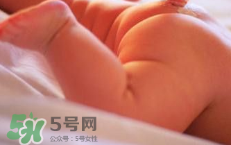 寶寶尿布疹可以擦紅霉素軟膏嗎？紅霉素軟膏對尿布疹有效嗎？