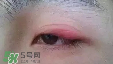 長期用假睫毛雙眼皮貼對眼睛有什么傷害？