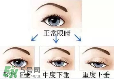 長期用假睫毛雙眼皮貼對眼睛有什么傷害？