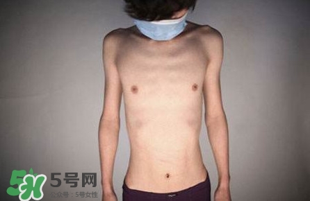 HIV真有這么可怕嗎？艾滋病的臨床表現(xiàn)主要有哪些