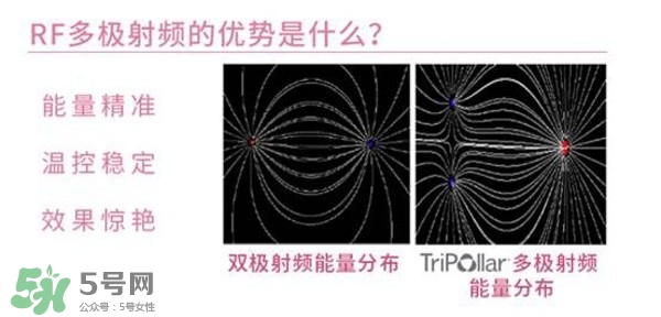 tripollar stop怎么樣？tripollar pose好用嗎