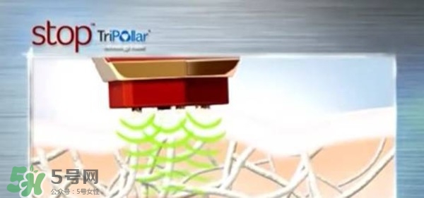 tripollar stop怎么樣？tripollar pose好用嗎