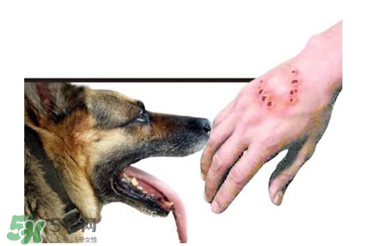 狂犬病會(huì)傳染嗎？狂犬病會(huì)學(xué)狗叫嗎