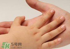 寶寶指甲凹凸不平是什么原因？寶寶指甲凹凸不平正常嗎？