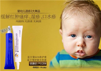 恩姆花園濕疹膏有激素嗎？恩姆花園濕疹膏含不含激素？
