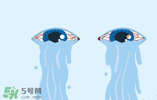 眼藥水可以兩個人用嗎？眼藥水可以共用嗎？