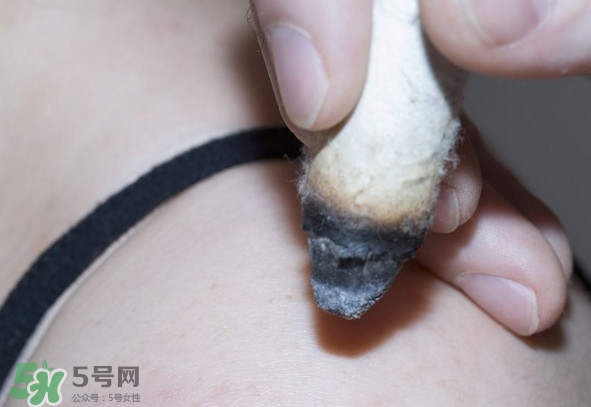 艾灸后為什么會(huì)癢？艾灸后為什么要多喝水