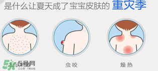 妙思樂爽膚水好用嗎？妙思樂爽膚水能去痱嗎？