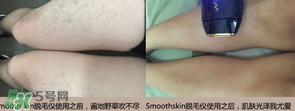 smoothskin和slikn infinity哪個好？smoothskin脫毛儀怎么樣