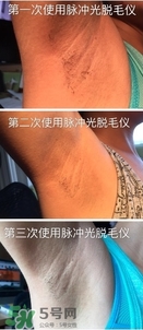 松下es wh93脫毛儀怎么樣？松下es wh93脫毛儀多少錢